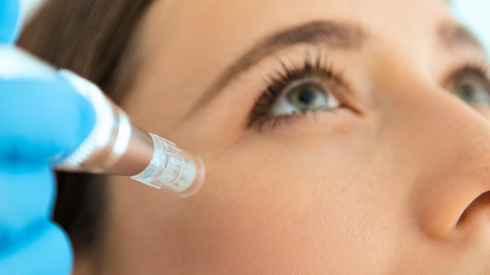 Microneedling Treatment Near Me
